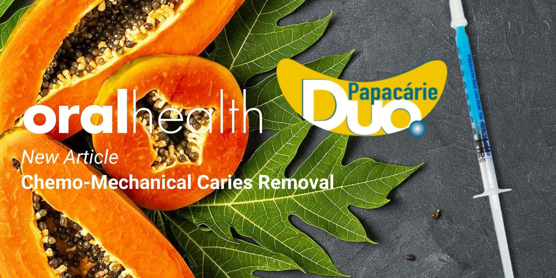 Chemo-Mechanical Caries Removal: Effectively Eliminating Decay and Stress