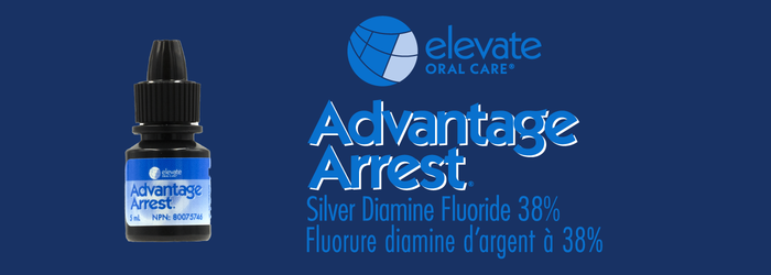 Oral Science Presents a New Adapted Format of the Leading Silver Diamine Fluoride Advantage Arrest Based on the Needs of Dental Hygiene Departments