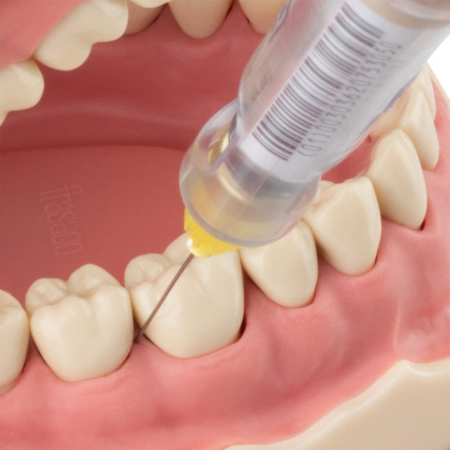 Woodpecker - Super Pen - Dispositif d’anesthésie dentaire